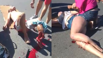 Couple On Honda Suffering Terrible Injuries