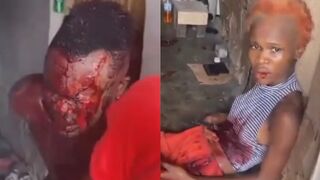 Man Lost An Eye After Getting Stabbed During Domestic Dispute