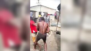 Man Lost An Eye After Getting Stabbed During Domestic Dispute