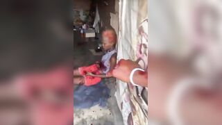 Man Lost An Eye After Getting Stabbed During Domestic Dispute