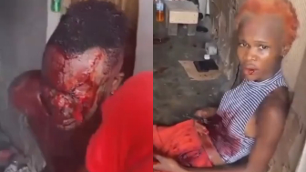Man Lost An Eye After Getting Stabbed During Domestic Dispute