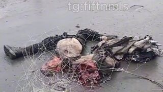 Civilian dismembered by drone.