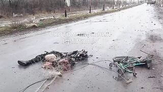 Civilian dismembered by drone.
