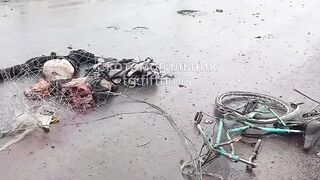 Civilian dismembered by drone.