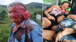 Gruesome Car Wreck: Two Women Dead, Driver Left with Scalped Face & Dangling Scalp