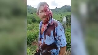 Gruesome Car Wreck: Two Women Dead, Driver Left with Scalped Face & Dangling Scalp