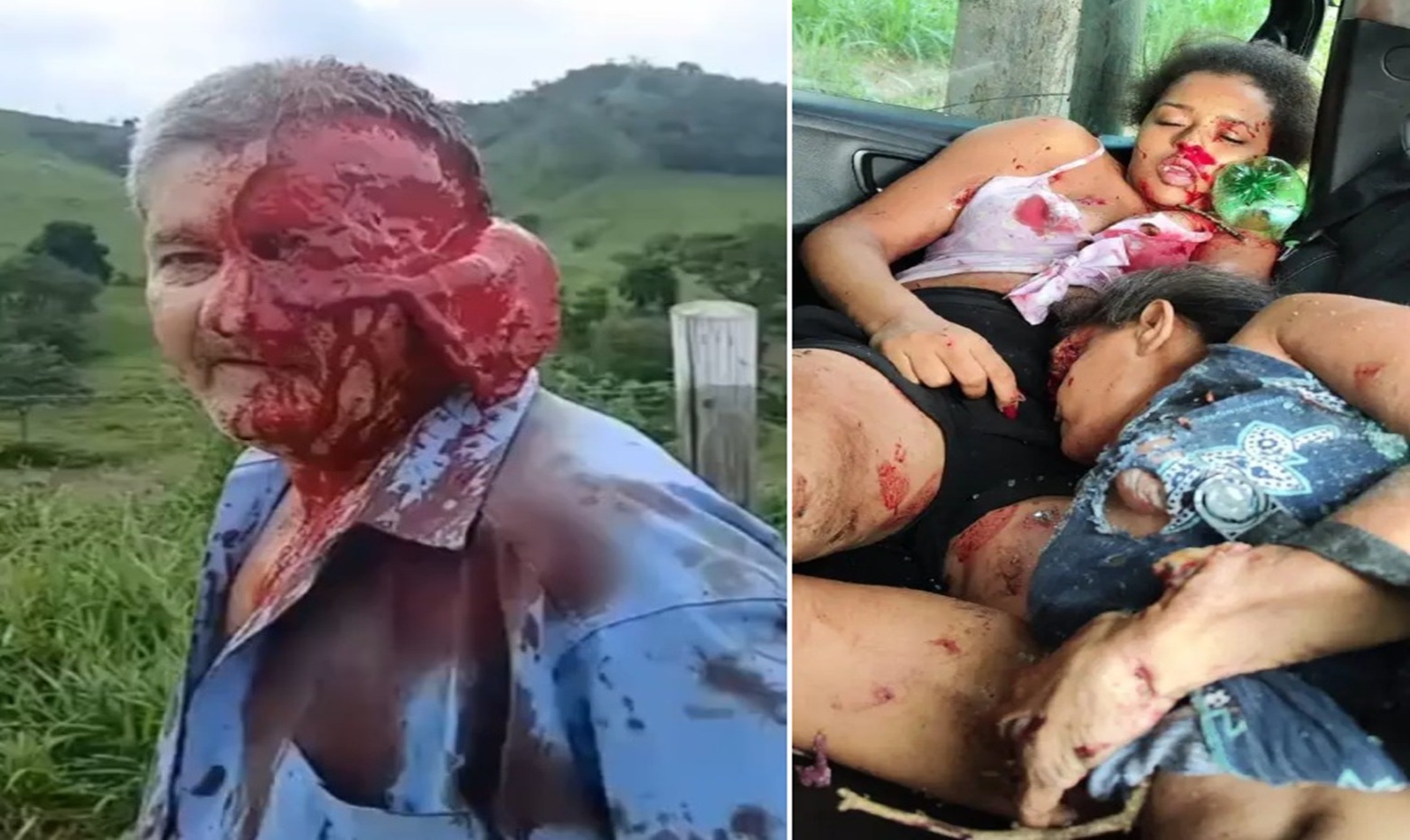 Gruesome Car Wreck: Two Women Dead, Driver Left with Scalped Face & Dangling Scalp