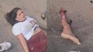 Traffic Accident In Venezuela Left Couple Seriously Injured