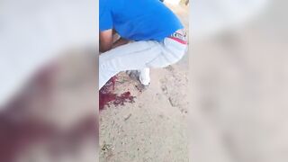 Traffic Accident In Venezuela Left Couple Seriously Injured