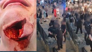 Suffolk Police impale 15yr old.