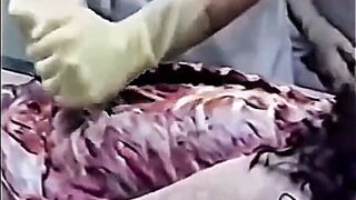 ⚠（ANATOMICAL）Female Autopsy ⚠