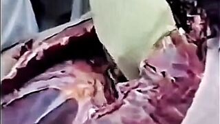 ⚠（ANATOMICAL）Female Autopsy ⚠