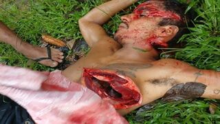 Mangled Man Convulses in Agonizing Pain, Covered in Machete Wounds and Filthy Mud