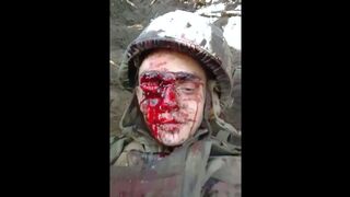 When This Russian Brown Eye Winks, the Trench Stinks!
