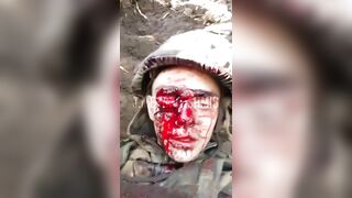 When This Russian Brown Eye Winks, the Trench Stinks!