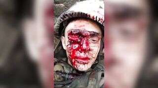 When This Russian Brown Eye Winks, the Trench Stinks!