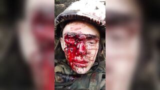When This Russian Brown Eye Winks, the Trench Stinks!