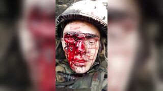When This Russian Brown Eye Winks, the Trench Stinks!