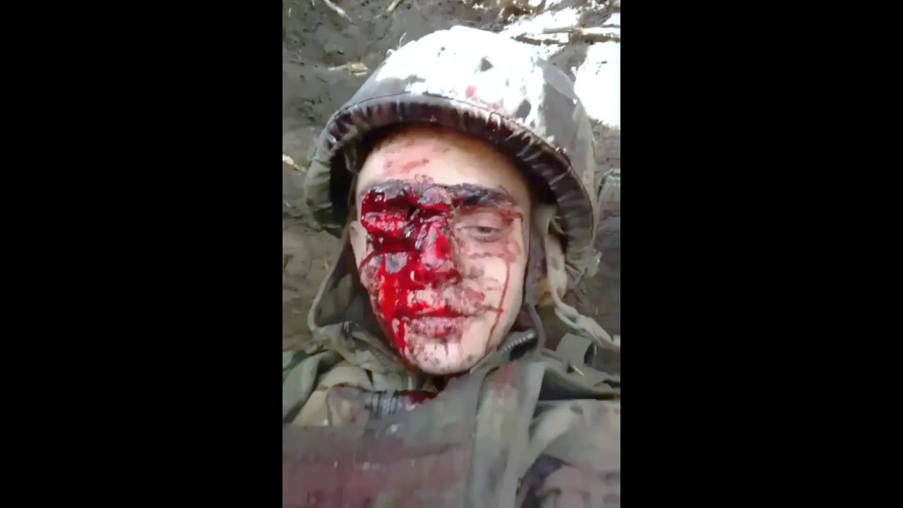 When This Russian Brown Eye Winks, the Trench Stinks!