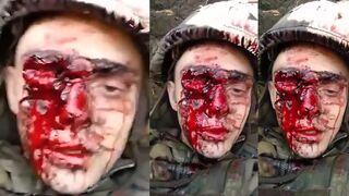 Orc reports on the situation at the front
