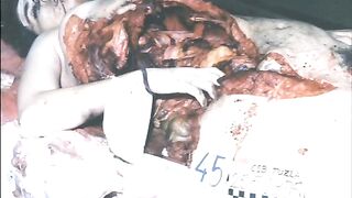 A Collection Of Photos Of Female Deaths