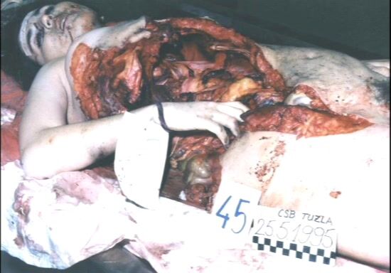 A Collection Of Photos Of Female Deaths