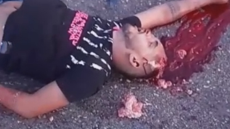 Helmet Could Probably Save Him
