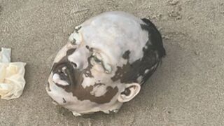 Dismembered Male Body Found On The Beach In  Brazil