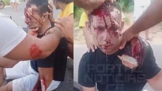 Man Impaled After Crashing Into A Fence