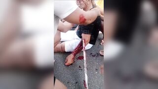 Man Impaled After Crashing Into A Fence