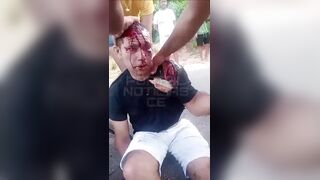 Man Impaled After Crashing Into A Fence
