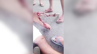 Man Impaled After Crashing Into A Fence