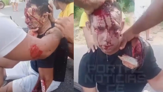 Man Impaled After Crashing Into A Fence