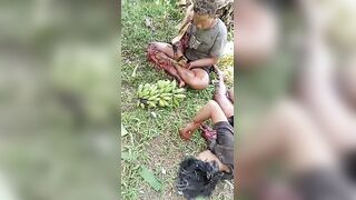 Severed Hands & Severe Wounds: Explosion Rocks Trio Making Illegal Explosive Firework