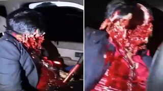 Skull Cleaved by Shotgun: Bloody Execution While Sitting Behind the Wheel