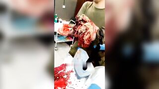Surgery on a wounded Russian soldier