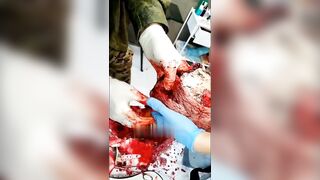 Surgery on a wounded Russian soldier