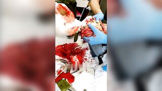 Surgery on a wounded Russian soldier