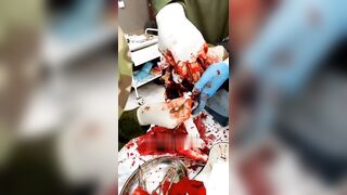 Surgery on a wounded Russian soldier