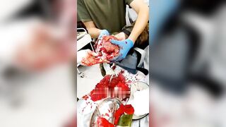 Surgery on a wounded Russian soldier