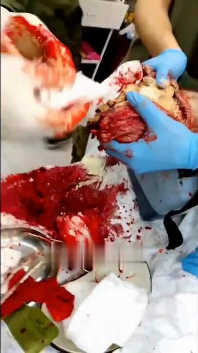 Surgery on a wounded Russian soldier