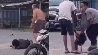 Dude Suffers A Seizure After Motorcycle Accident
