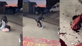 woman attacked with machete