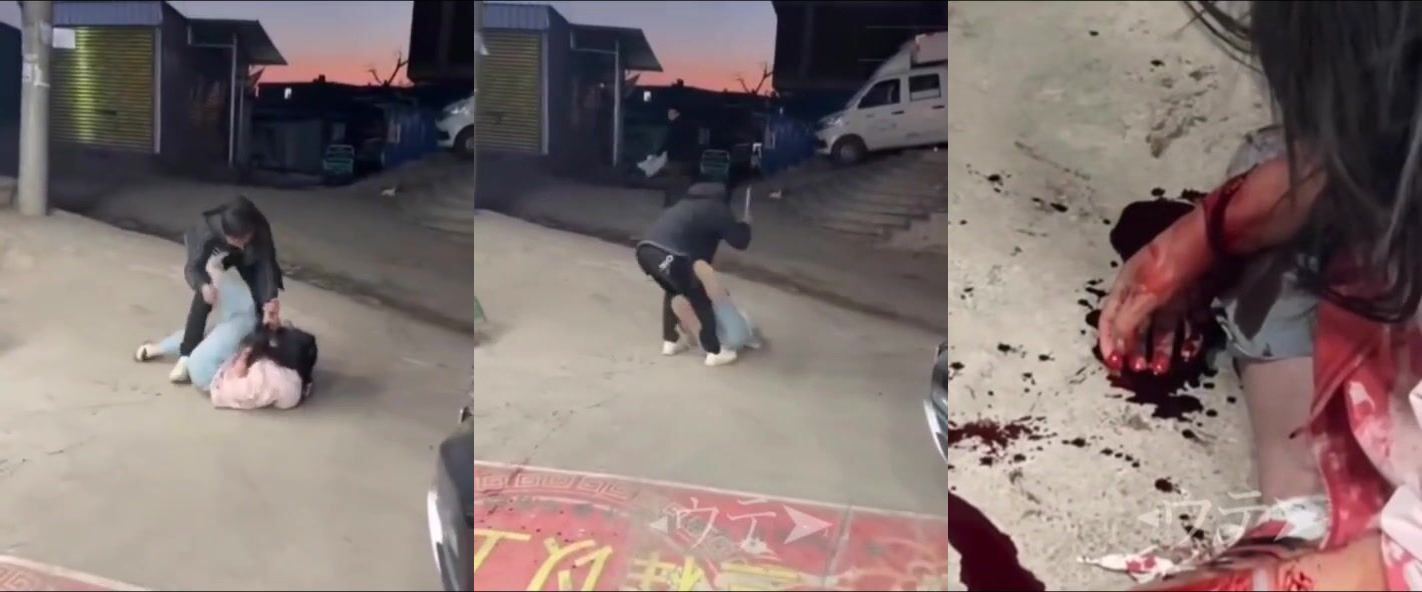 woman attacked with machete