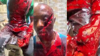 A man was attacked with a sword