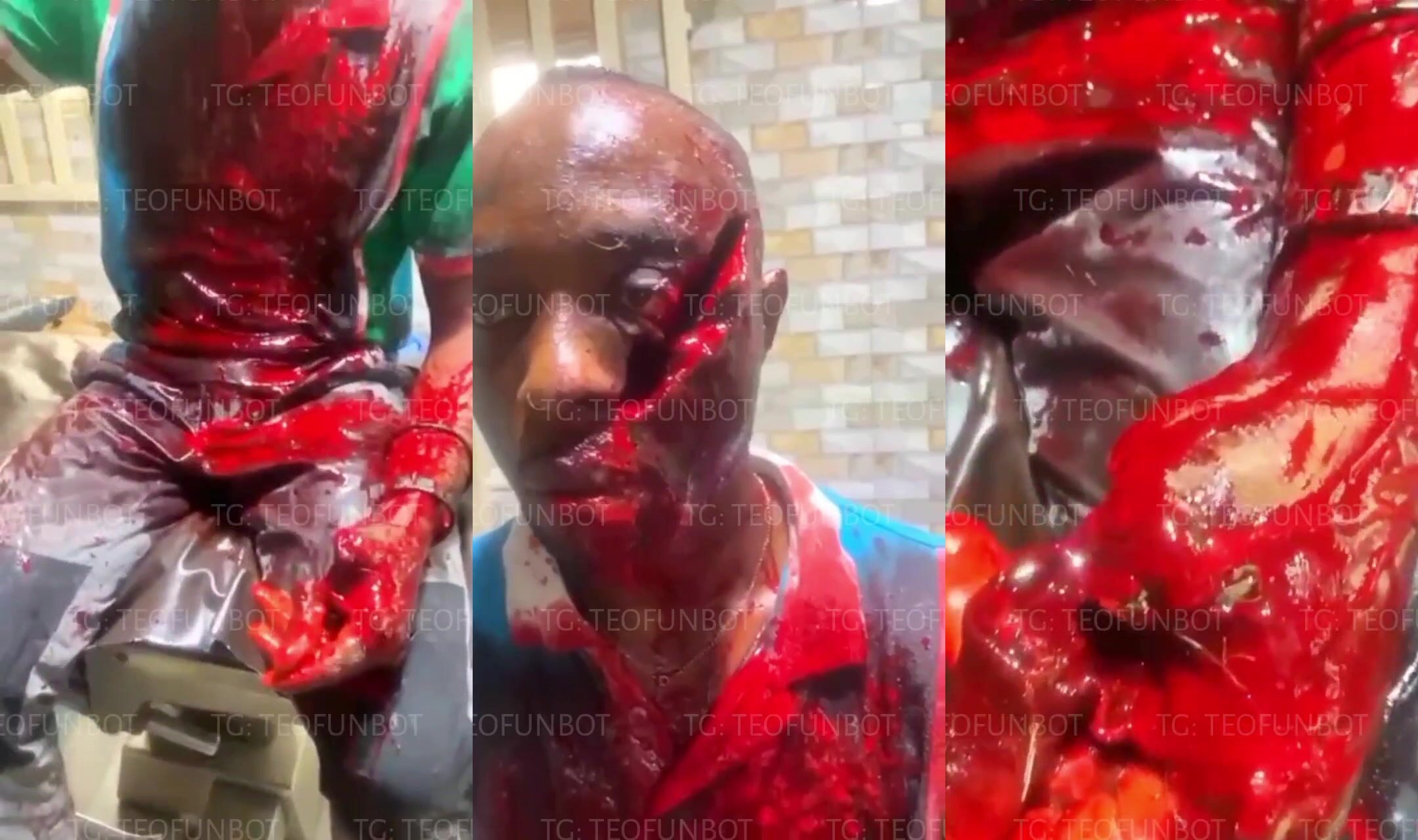 A man was attacked with a sword