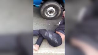 I’d Say He Got Brain Damage But That’d Imply He Had One Before