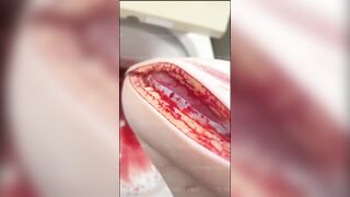 scarification compilation