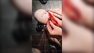 scarification compilation