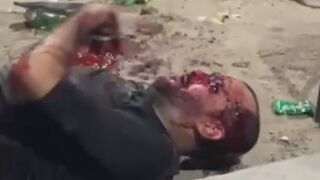 Man Suffers After Being Beaten And Stabbed During A Drunk Fight